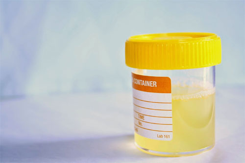 Como fazer exame de urina pelo SUS